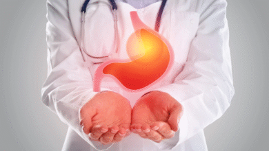 Top Solutions for Managing Hunger After Gastric Sleeve Surgery